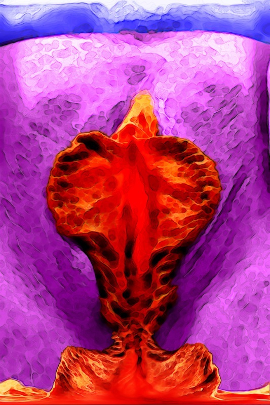 Loading Image